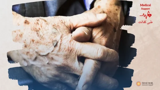 Diabetes – Finger Amputation Inevitable