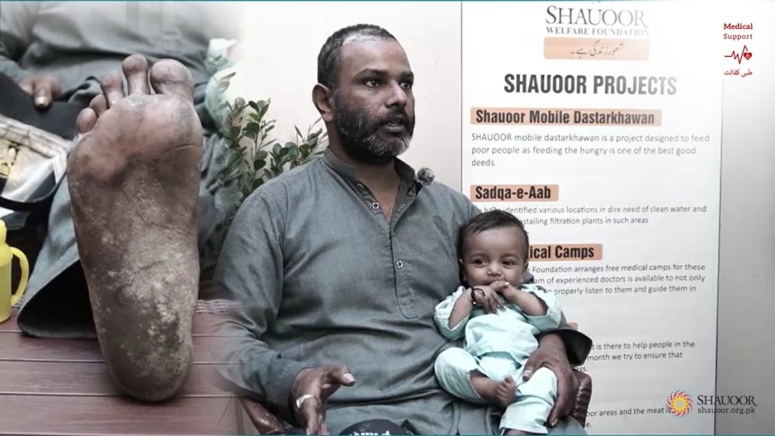 fungus infection medical support