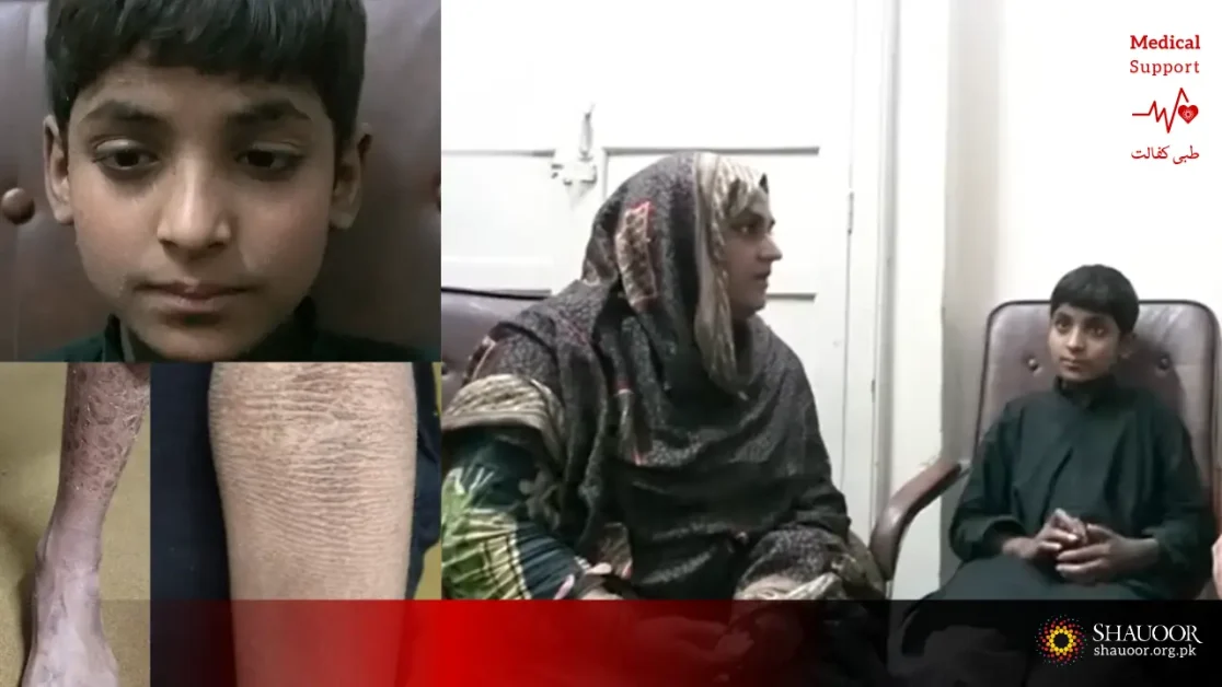 Lifelong Disease with Shehroz