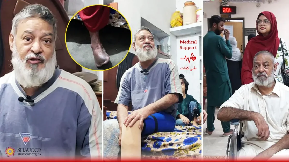 Diabetes, Artificial Leg & Paralysis