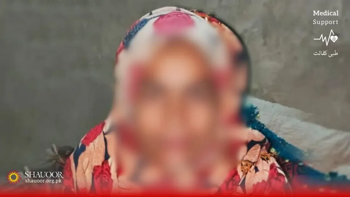 Brain Tumor - Immediate Surgery