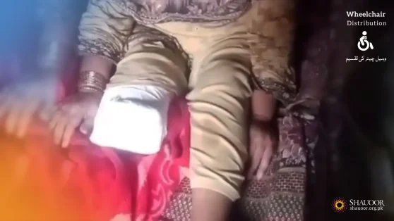 Diabetes & Amputated Leg - Wheelchair Appeal