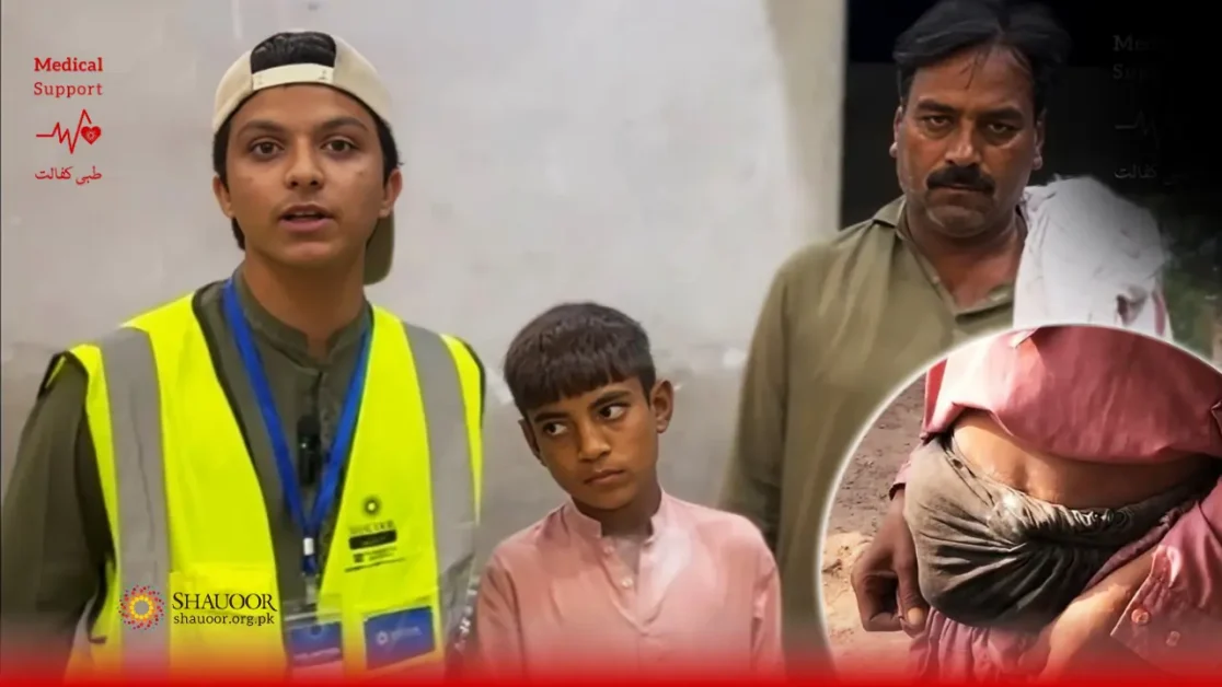 Rectal Prolapse – Urgent Surgery