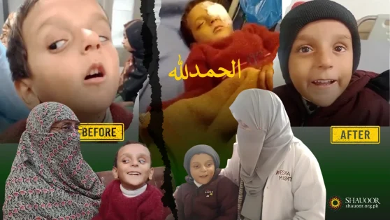 Little-Ali-Sher-Successful-Eye-Surgery-Follow-up-Shauoor-Maan-Ghar