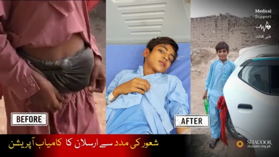 Arsalan – Successful Intestinal Surgery