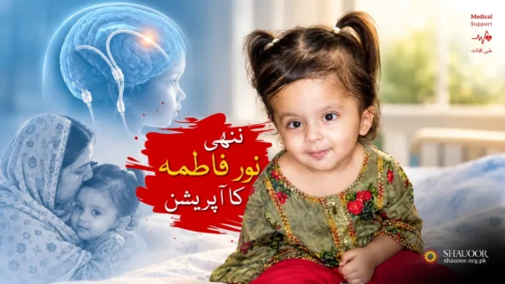 Little Noor Fatima's Surgery – PKR 35K